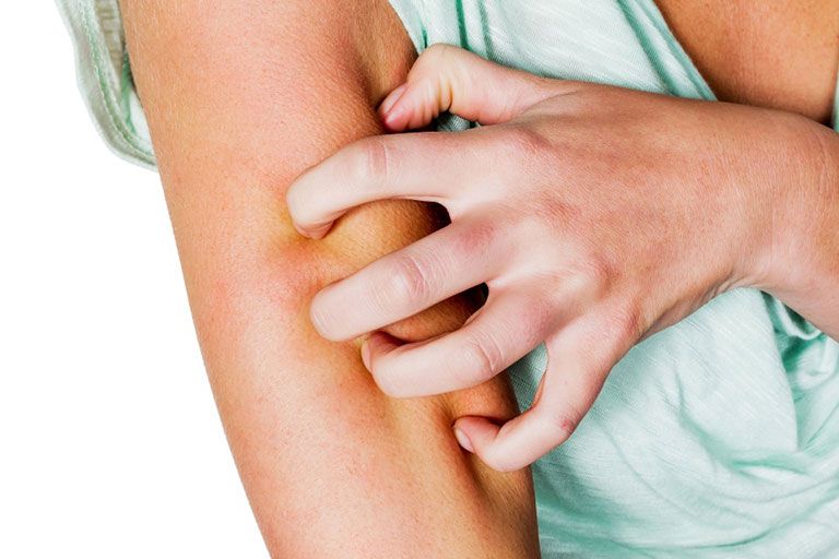 Người bệnh không nên chà xát, gãi vùng da tổn thương