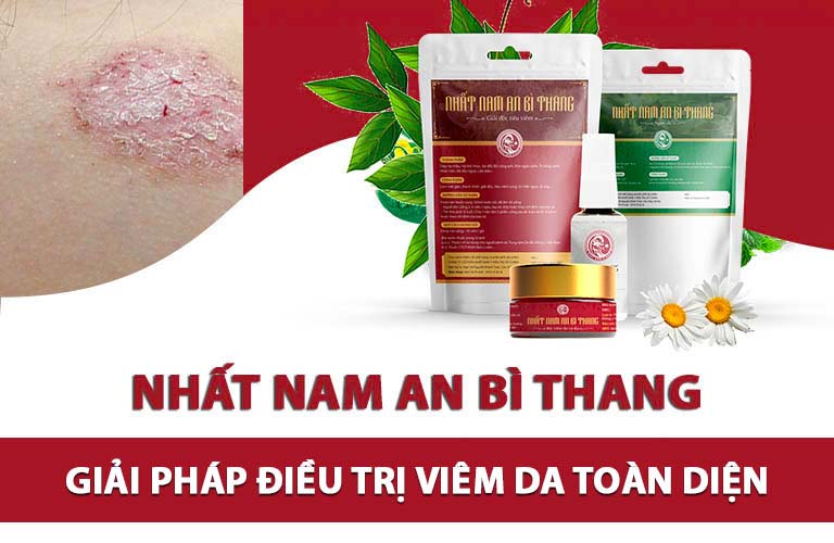 Nhất Nam An Bì Thang đẩy lùi tận căn nguyên gây bệnh