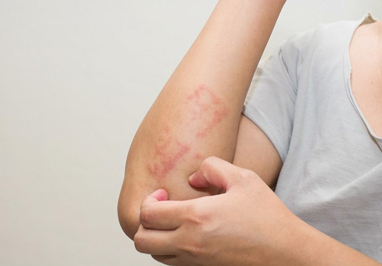 Nếu không được điều trị, bệnh gây ra nhiều biến chứng