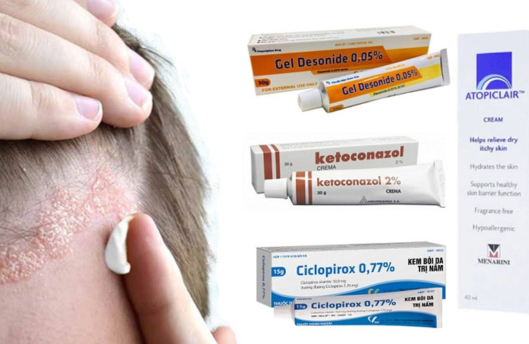 Có thể sử dụng các loại thuốc bôi để điều trị viêm da tiếp xúc ở mặt