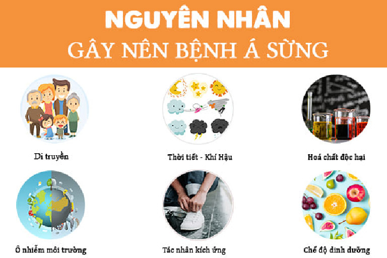 benh a sung o chan benh a sung o chan