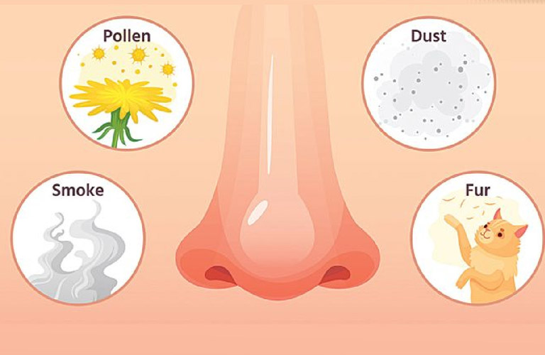 Bệnh có thể xảy ra bởi khó bụi, phấn hoa, vi khuẩn nấm mốc