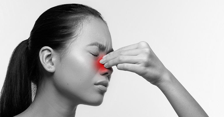 Viêm xoang là một bệnh lý liên quan đến nhiễm trùng hoặc viêm các hốc xoang