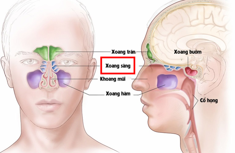Có rất nhiều người mắc bệnh viêm xoang sàng