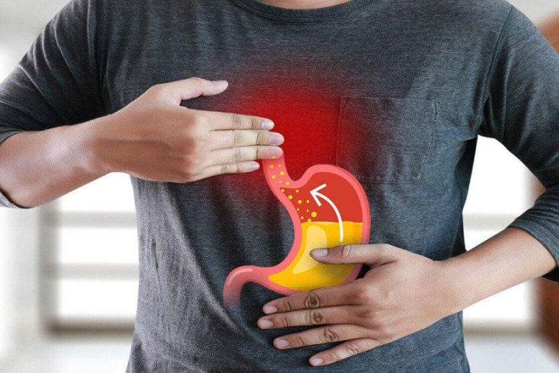 Trào ngược dạ dày có thể dẫn đến nhiều biến chứng nguy hiểm nếu không được điều trị hiệu quả