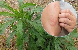 3 Cách Dùng Cây Ngải Dại Chữa Viêm Da Cơ Địa Hiệu Quả