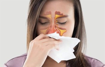 Viêm Xoang Có Di Truyền Không? Giải Đáp Từ Chuyên Gia 