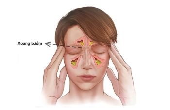 Xoang Bướm: Vị Trí, Công Dụng Và Các Bệnh Lý Thường Gặp