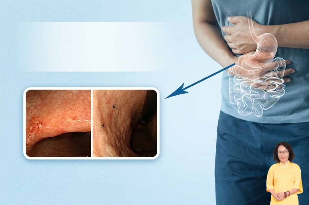 vị trí đau dạ dày