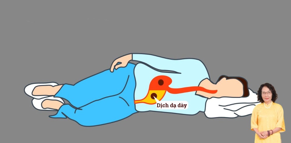 Đau dạ dày nên nằm tư thế nào để dễ chịu hơn